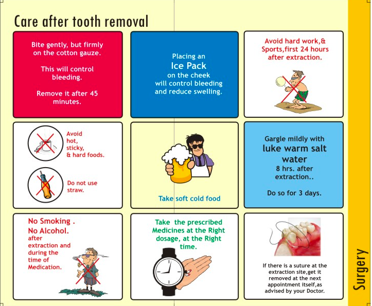 Root Canal